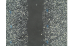 【技術(shù)視頻】細(xì)胞劃痕實(shí)驗(yàn)